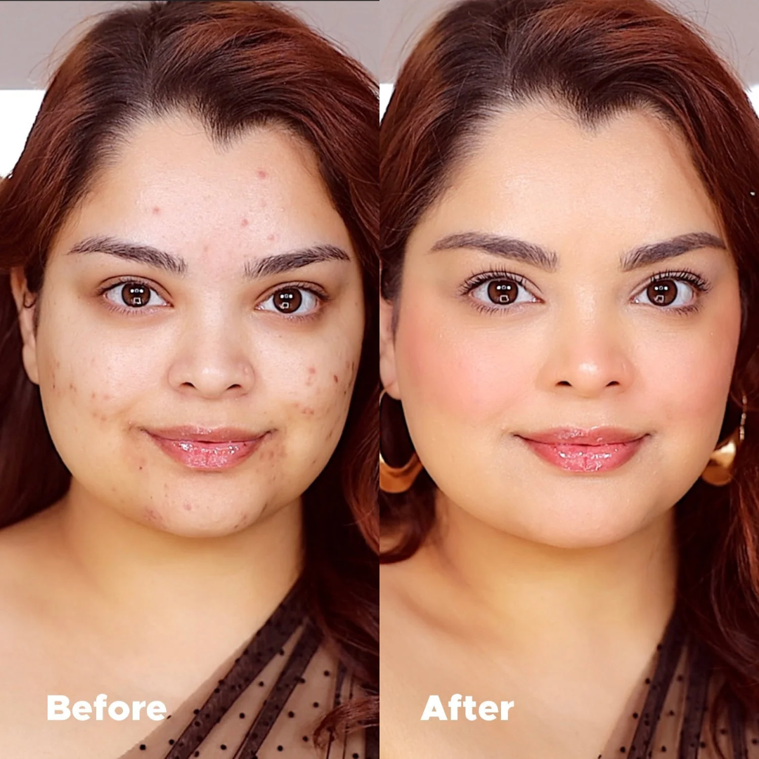 Universal Concealer